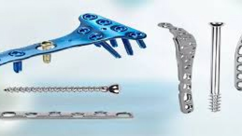 Orthopedic Implants 2024–2032: Innovation in Hip, Knee, and Spine Solutions