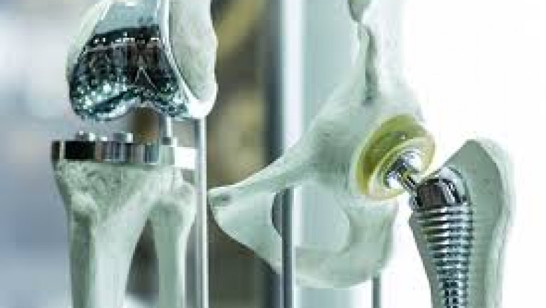 Medical Implant Industry Report 2025–2035: Key Segments, Players, and Emerging Markets