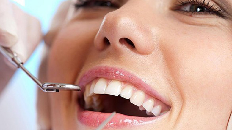 Holistic Dentistry in Tampa: Embracing Natural Approaches to Oral Health