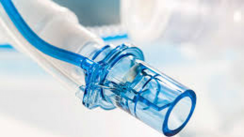 Global Medical Airflow Sensor Market Report: Trends, Opportunities, and Forecast 2025-2031