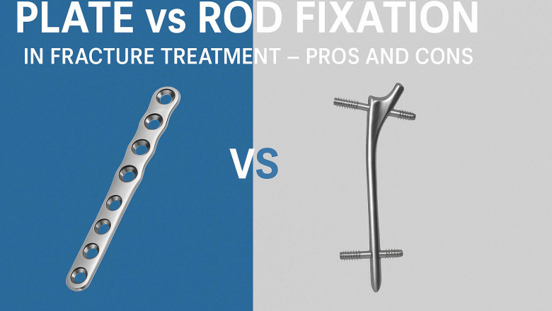 Plate vs Rod Fixation in Fracture Treatment – Pros and Cons