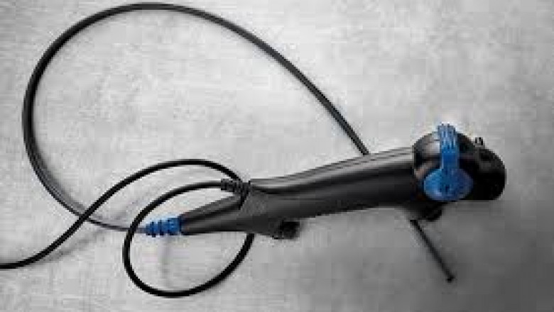 Single-Use Bronchoscopes Market Future Trends Shaping Medical Device Innovation