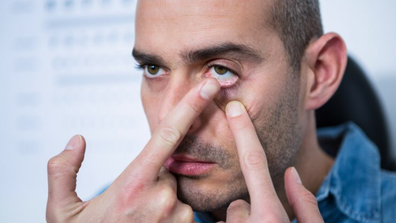 Dry Eye Syndrome Market Landscape Witnesses Rapid Advancements in Diagnostics and Targeted Therapeutics Globally