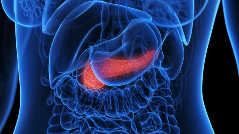 Pancreatic Cancer Therapeutics & Diagnostics Market Estimated to Surge on Liquid Biopsy