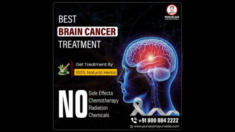 Best Brain Cancer Treatment Hospitals in Hyderabad