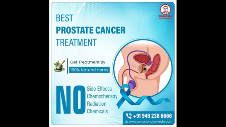 Best Prostate Cancer Treatment Hospital in Bangalore