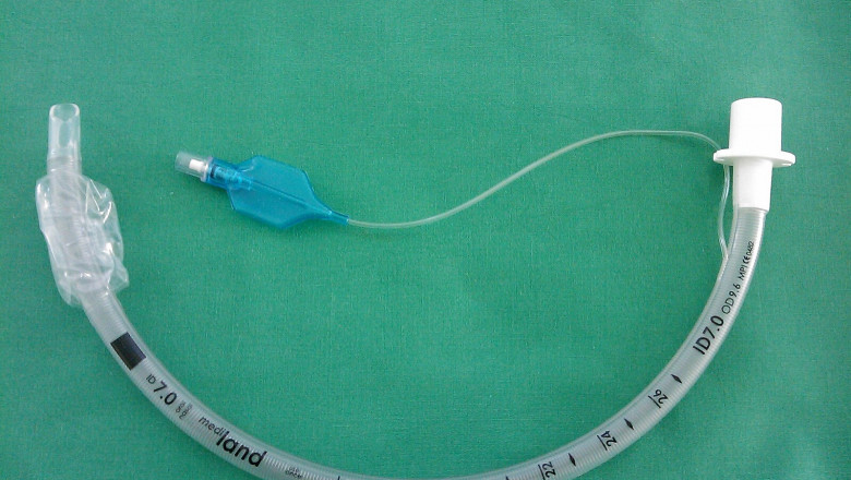 Tracheal Tube And Airway Products Market is Estimated to Witness High Growth Owing to Advanced Ventilation Technology