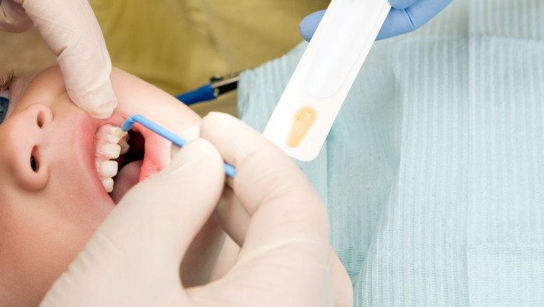 Dental Silver Diamine Fluoride Market Growth Driven by Rising Preventive Care and Expanding Applications Worldwide
