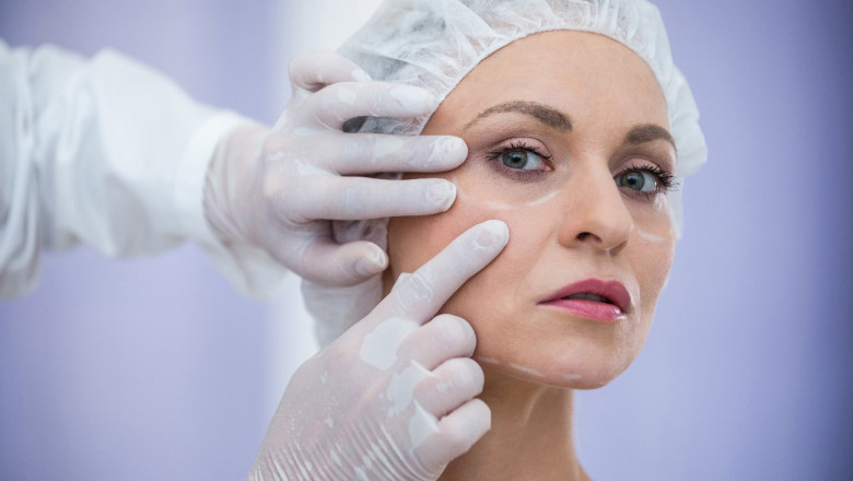 Botox Mississauga