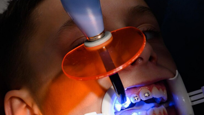 Dental Anesthetics Market Key Pain Points and Solutions in Global Oral Care Industry