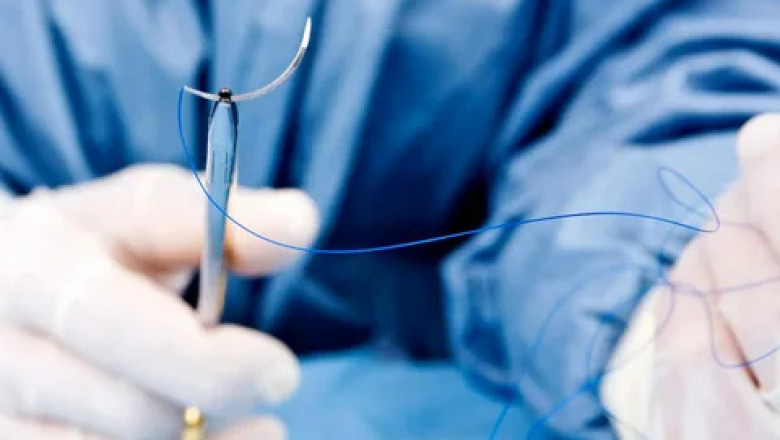 Dental Suture Market Overview and Strategic Insights