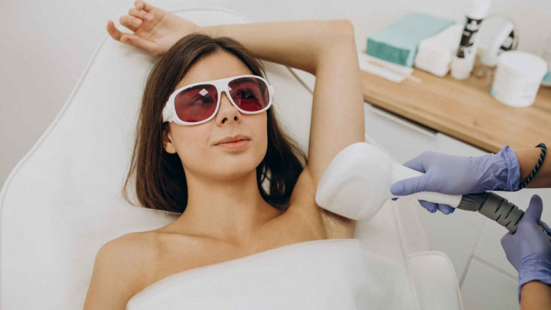 Laser Hair Removal Burlington