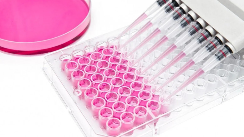 In Vitro Diagnostics Test Kit Market Challenges Include Supply Chain Disruptions Worldwide