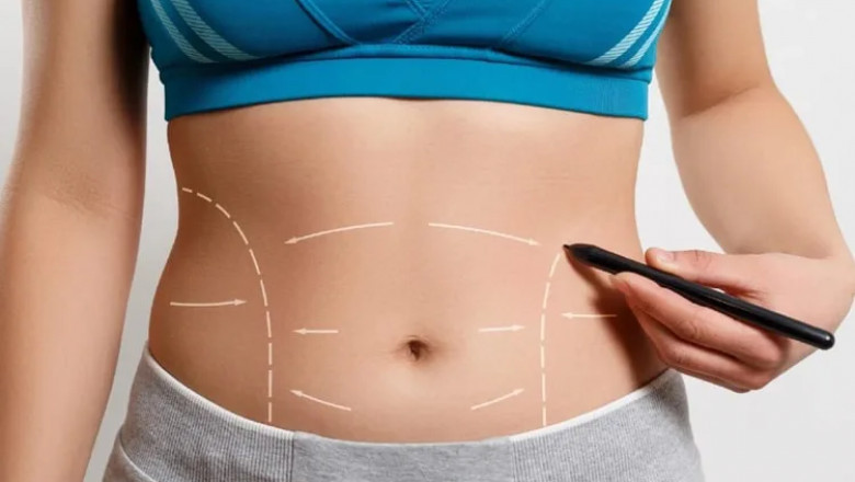 Liposuction in Dubai: How to Choose Between Liposuction and Tummy Tuck Surgery