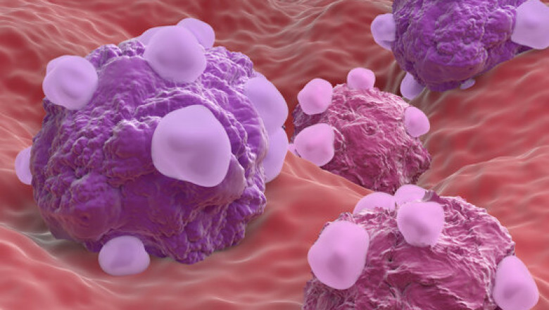 Clear Cell Ovarian Cancer Market Growth and Forecast