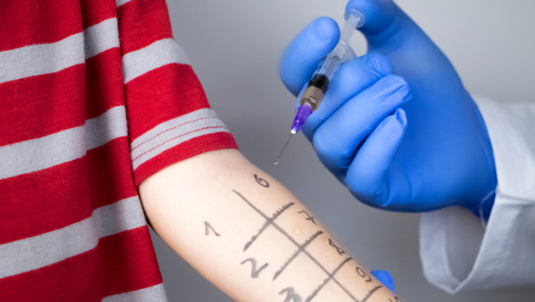 Food, Pollen, or Pets? What You’ll Learn from Allergy Testing in Chicago