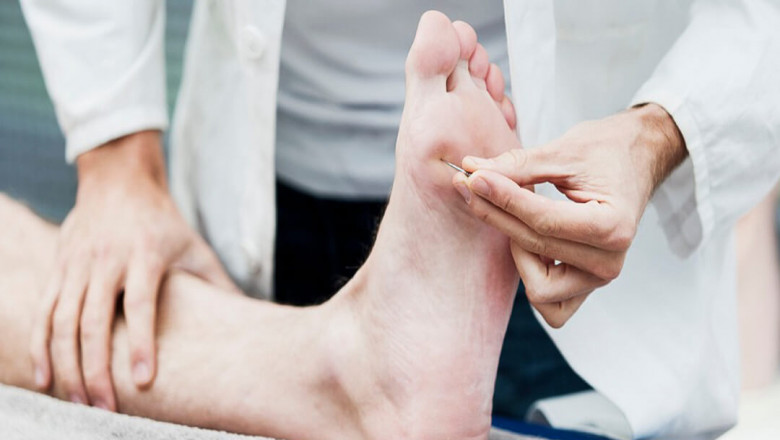Mental and Emotional Health in Small Fiber Neuropathy Treatment: Strategies That Work