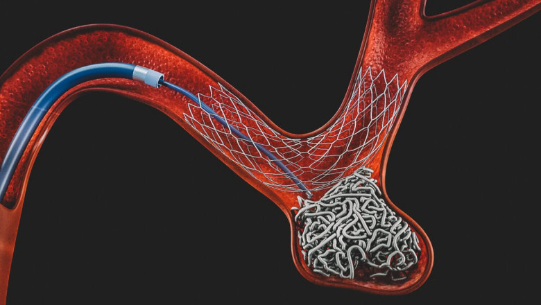 Vascular Patches Market: Size, Trends, and Strategic Outlook 2025-2032