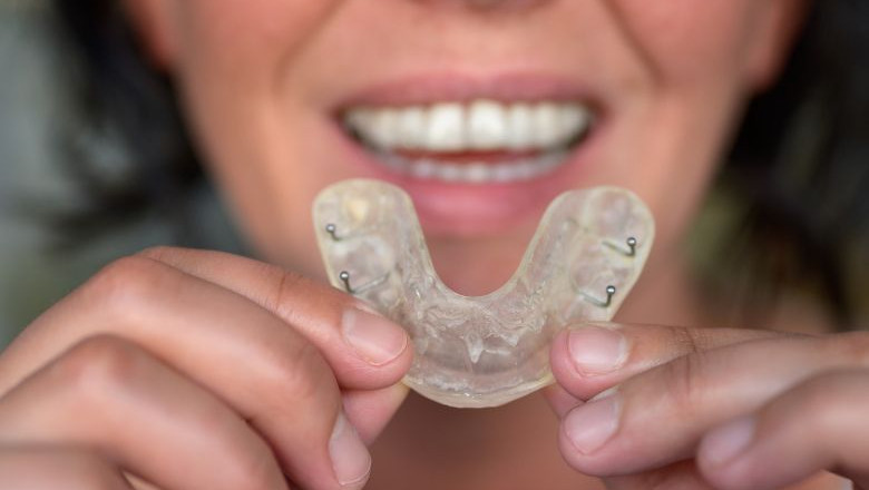 Why Custom Mouthguards Matter for Sports and Night-Time Protection