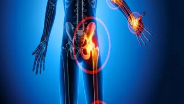 Exploring the Potential of Orthobiologics in Regenerative Medicine