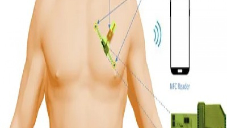 Revolutionary ECG Sensor Patches Transform Cardiac Monitoring Through Advanced Wearable Technology