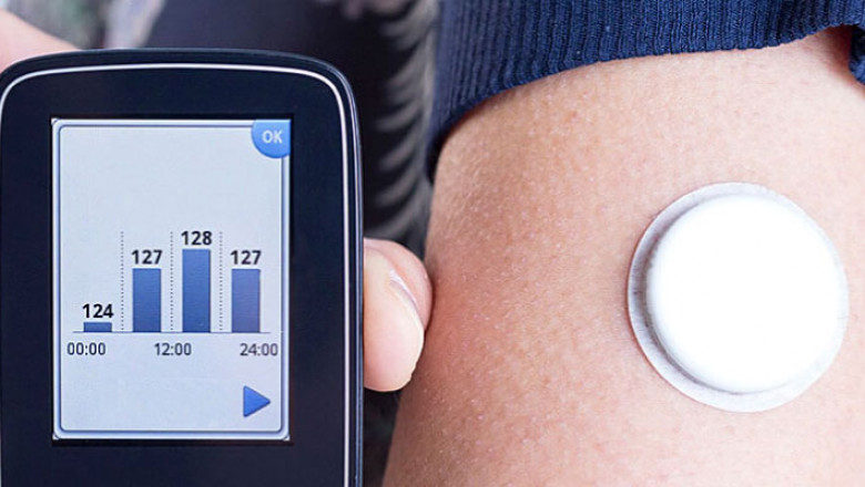 United States Continuous Glucose Monitoring Market Growth and Trends Analysis