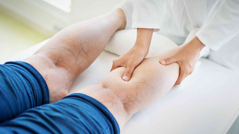 Advanced Varicose Vein Treatment Devices Revolutionizing Modern Healthcare Solutions Worldwide