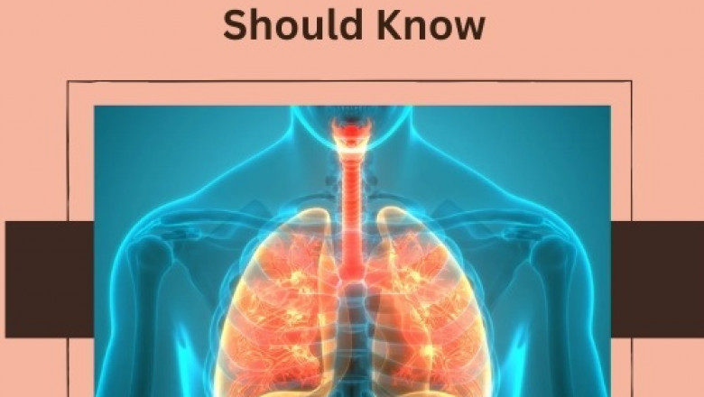 Promising New Treatments for Bronchiectasis: What You Should Know