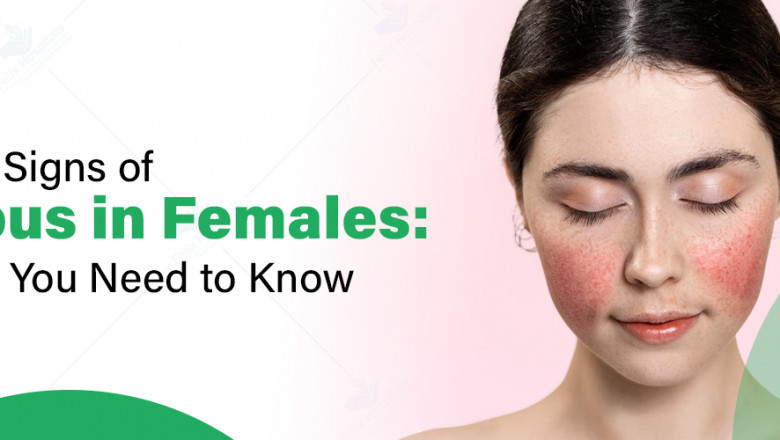 Lupus Symptoms in Women: A Complete Guide to Diagnosis, Types, and Care