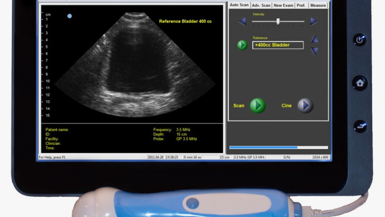 Portable Ultrasound Bladder Scanner Market Developments Highlighting Innovations and Global Growth Opportunities