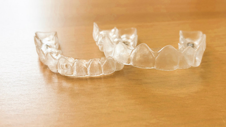 Orthodontist in kirkland - Redmond Orthodontics