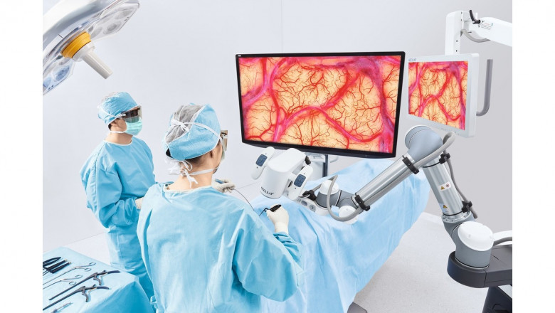 Surgical Microscope Market Growth Opportunities Driven by Technological Innovations and Healthcare Advancements