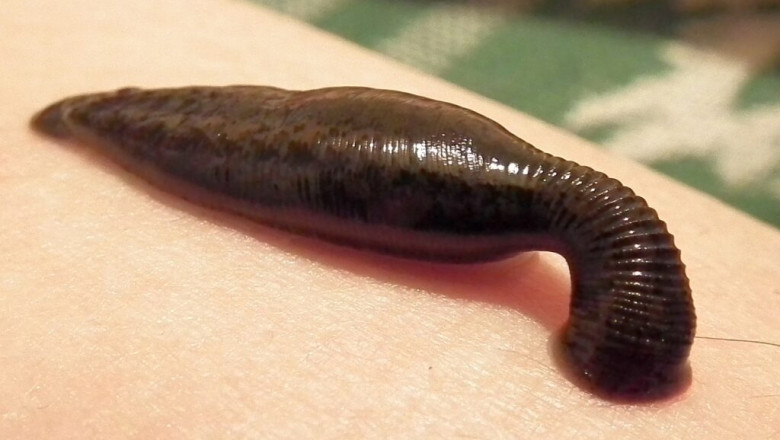 How Leech Therapy Works: Insights from Mumbai Experts
