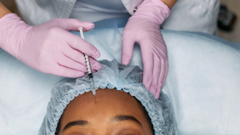 5 Real Benefits of Botox: Why People Love It