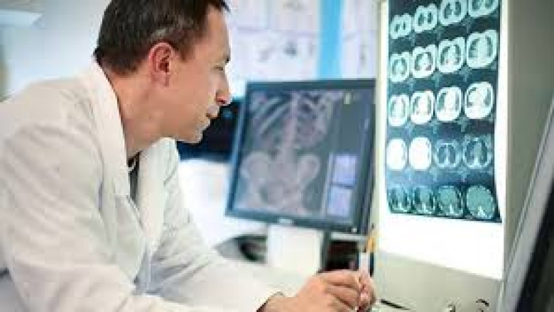 The Rising Need for Accurate Alzheimer’s Diagnostics by 2032