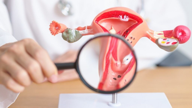 Best Clinics and Doctors for Pap Smear in Dubai: Finding the Right Care