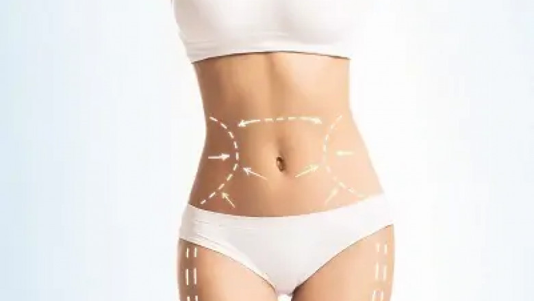 How Mini Tummy Tuck in Dubai Compares to Full Tummy Tuck Surgery