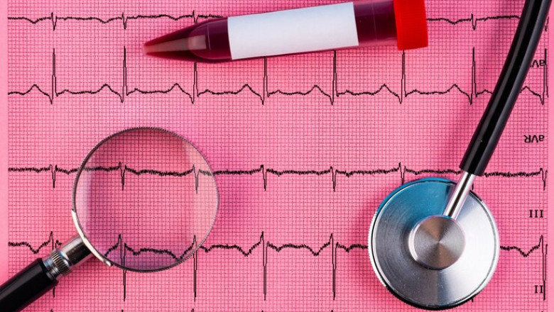 Atrial Fibrillation (Afib) Market Witnessing a Significant Shift Driven by Technological and Therapeutic Advances