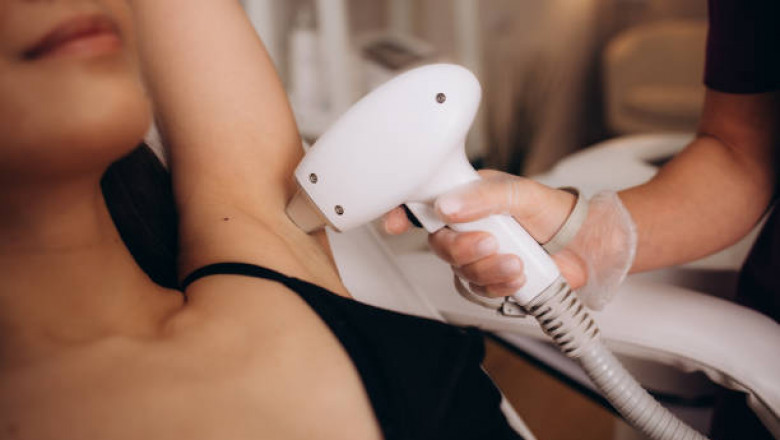 Everything You Need to Know About Laser Hair Removal in Toronto