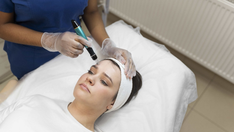 How to Choose Dermal Fillers in Mississauga