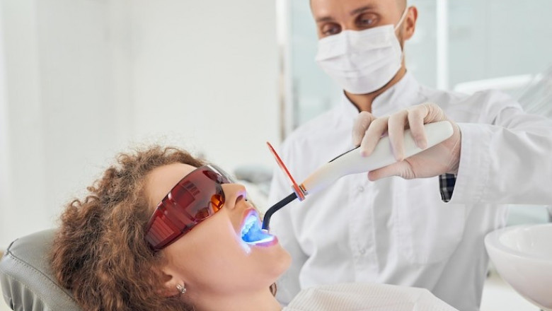 How Professional Teeth Bleaching Enhances Your Smile Safely