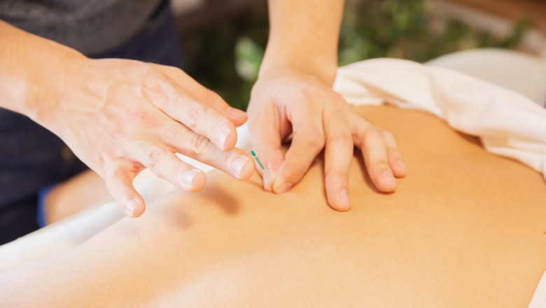 Mixed-Reality Acupuncture in Edmonton: The Future of Natural Healing Is Here