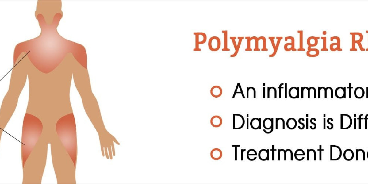 From Bench to Bedside: The Evolution of Polymyalgia Rheumatica Research
