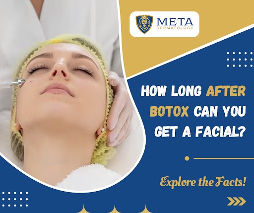 Can I Get a Facial After Botox? Explore the Facts!