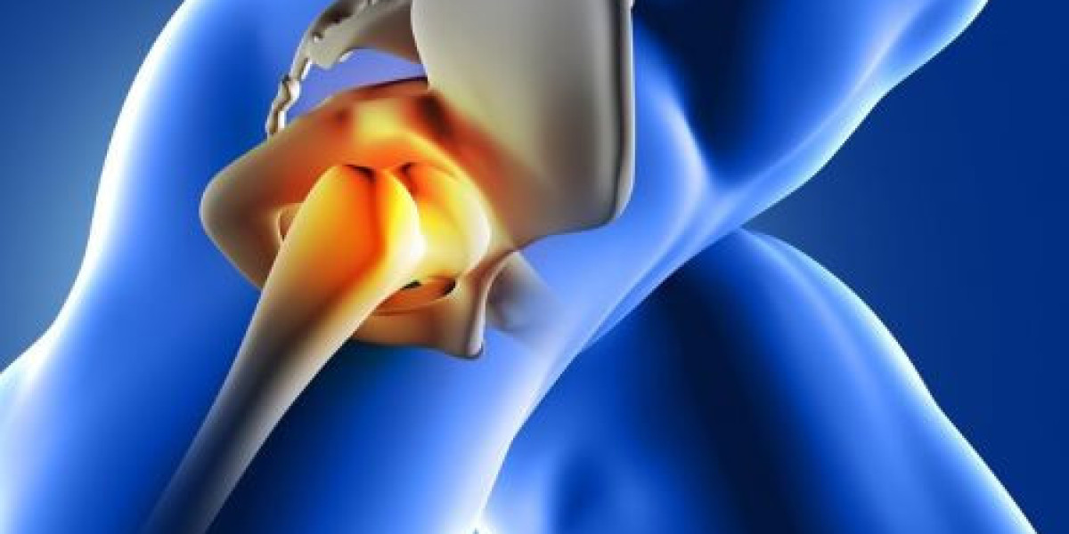 Hip Replacement Market Data 2024-2033: Size, Trends, and Insights