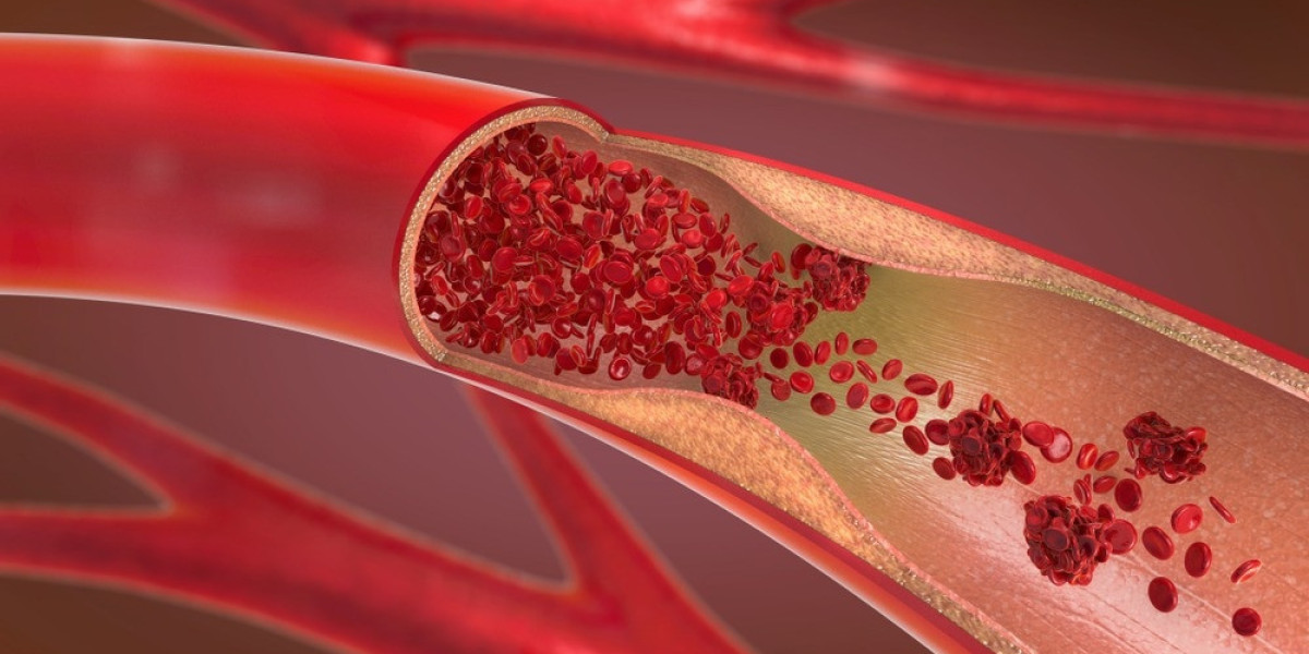 Vascular Grafts Market: Outlook, Overview, Major Key Players And Industry Analysis Till 2033