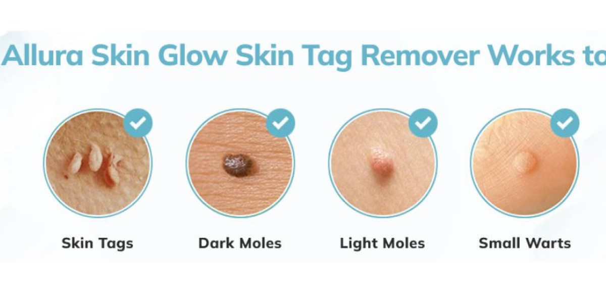 Here to Buy Allura Skin Glow Skin Tag Remover For a Special Discounted Price Today