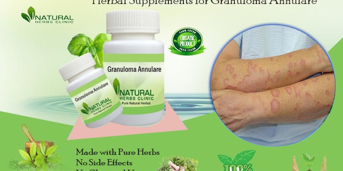 Top Treatments for Granuloma Annulare: A Complete Guide