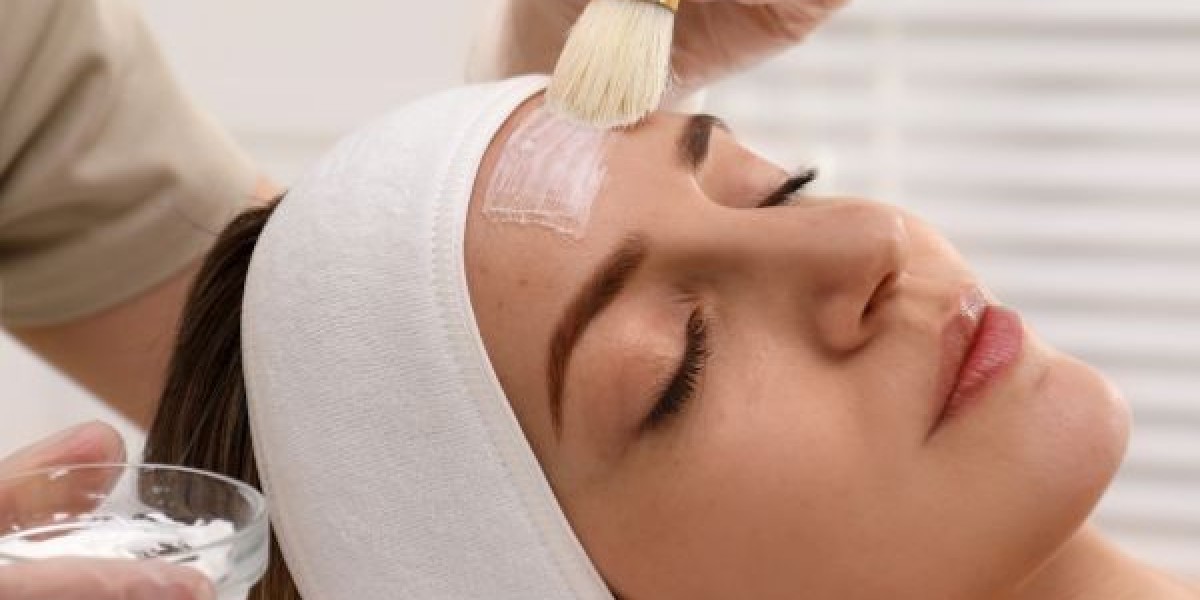 Exploring the Ingredients in Popular Chemical Peels