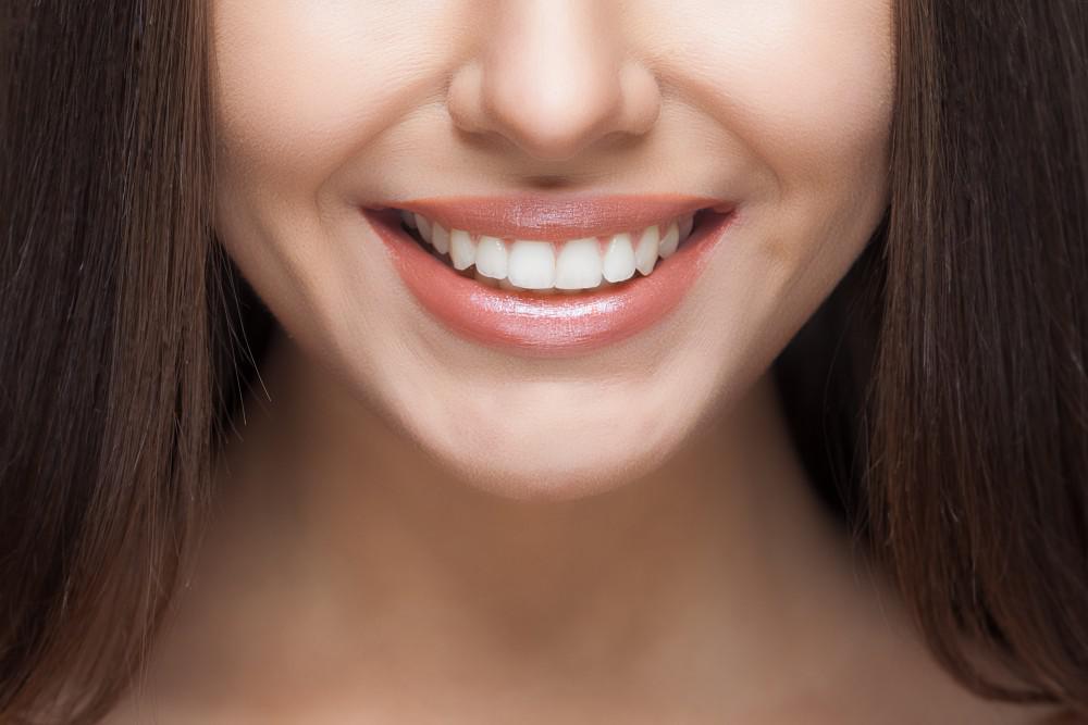 Hollywood Smile in Abu Dhabi | Cosmetic Dentistry Abu Dhabi